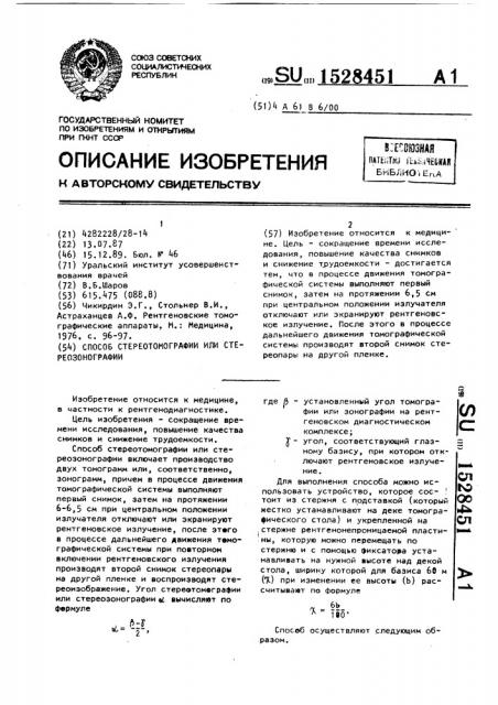 Способ стереотомографии или стереозонографии (патент 1528451)