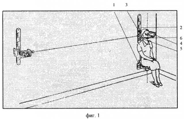 Устройство для фиксации головы при фотометрии (патент 2253361)