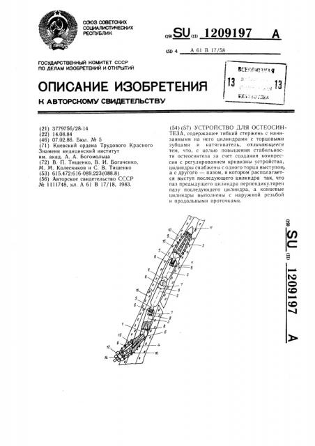 Устройство для остеосинтеза (патент 1209197)