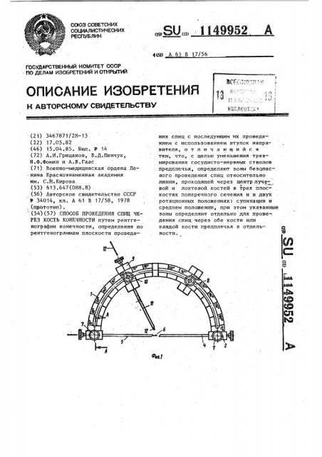 Способ проведения спиц через кость конечности (патент 1149952)