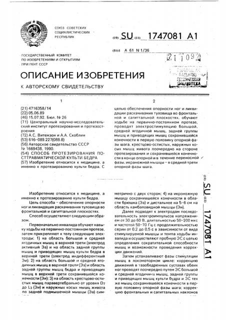 Способ протезирования посттравматической культи бедра (патент 1747081)