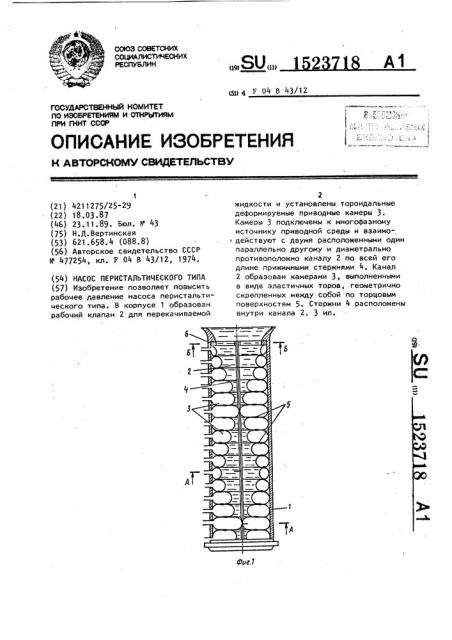 Насос перистальтического типа (патент 1523718)