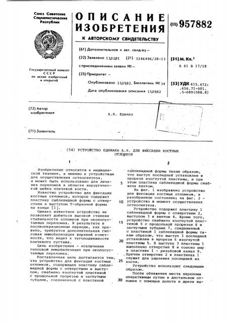 Устройство единака а.н. для фиксации костных отломков (патент 957882)