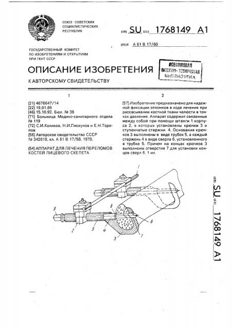 Аппарат для лечения переломов костей лицевого скелета (патент 1768149)