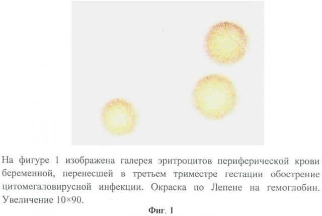 Способ оценки индуцирующего действия цитомегаловирусной инфекции на оксигенацию гемоглобина в третьем триместре гестации на фоне определения количества гемоглобина и 2,3 дфг в эритроцитах периферической крови (патент 2504775)