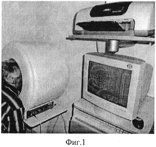 Способ определения характеристик зрения и устройство для его осуществления (патент 2576798)