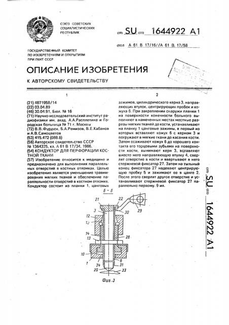 Кондуктор для перфорации костной ткани (патент 1644922)