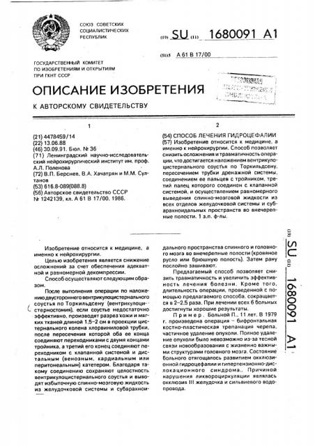 Способ лечения гидроцефалии (патент 1680091)