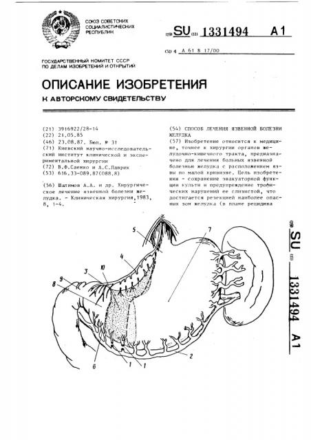 Способ лечения язвенной болезни желудка (патент 1331494)