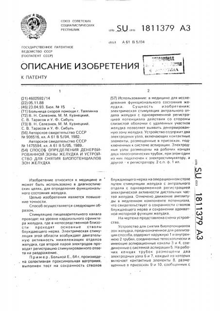 Способ определения денервированной зоны желудка и устройство для снятия биопотенциалов зон желудка (патент 1811379)