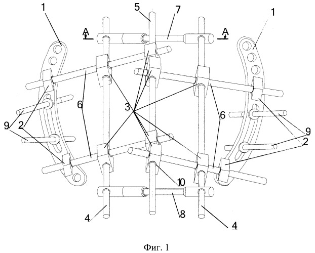 Устройство для репозиции и фиксации переломов костей таза с разрывом переднего и заднего полуколец (патент 2372868)