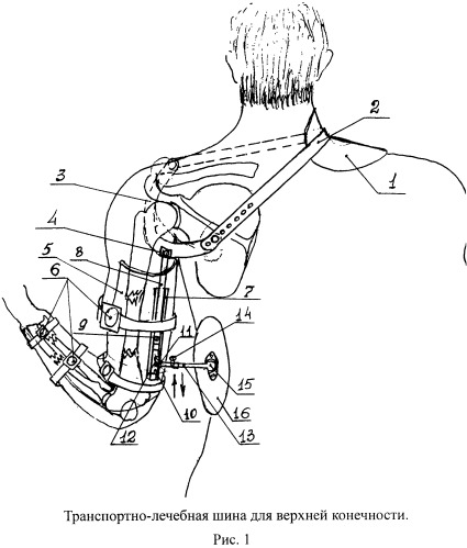 Транспортно-лечебная шина для верхней конечности (патент 2534232)