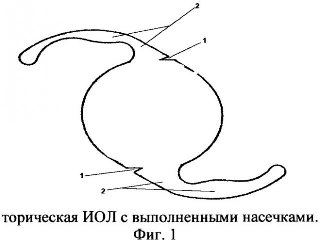 Способ повышения ротационной стабильности торических интраокулярных линз (патент 2535612)