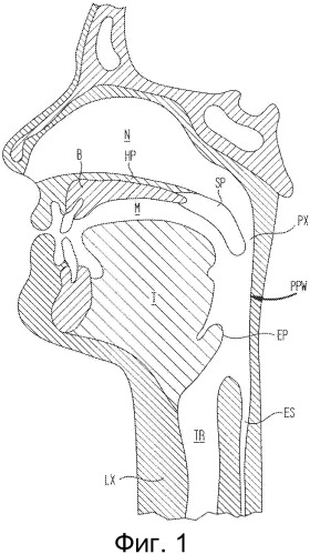 Способы и устройства для формирования вспомогательного дыхательного пути для лечения обструктивного апноэ во сне (патент 2497485)