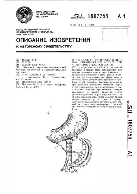 Способ хирургического лечения ишемического колита при аневризме брюшной аорты (патент 1607785)