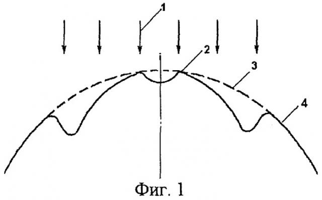 Способ хирургической коррекции пресбиопии в сочетании со сложным гиперметропическим астигматизмом (патент 2314075)
