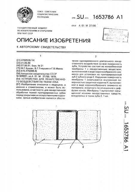 Устройство для лекарственного воздействия на ткани зуба (патент 1653786)
