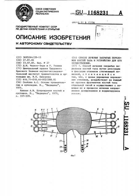 Способ лечения закрытых переломов костей таза и устройство для его осуществления (патент 1168231)