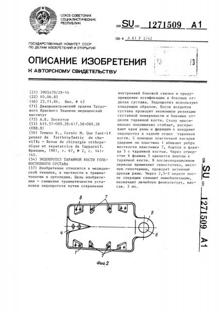 Эндопротез таранной кости голеностопного сустава (патент 1271509)