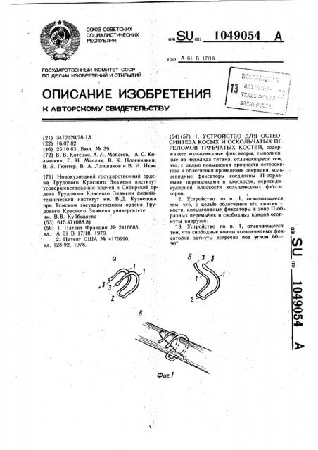 Устройство для остеосинтеза косых и оскольчатых переломов трубчатых костей (патент 1049054)