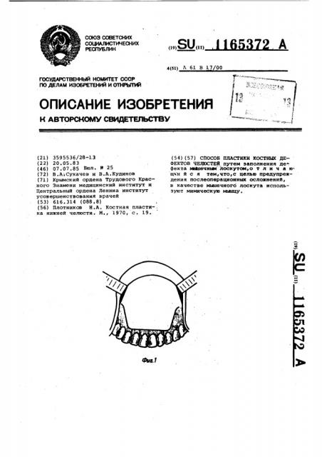 Способ пластики костных дефектов челюстей (патент 1165372)