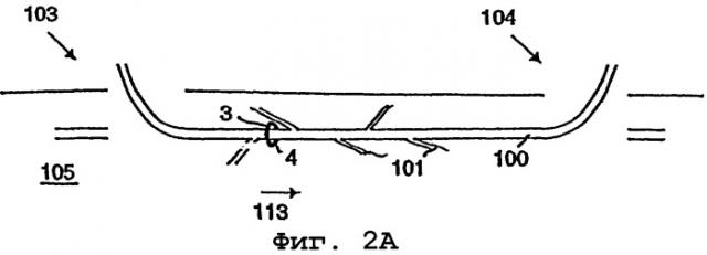 Электрохирургический венозный стриппер (варианты) (патент 2301044)