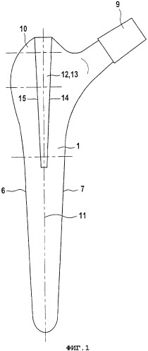 Комплект, состоящий из протеза бедра с вставляемым в бедренную кость стержнем и инструмента (патент 2341231)