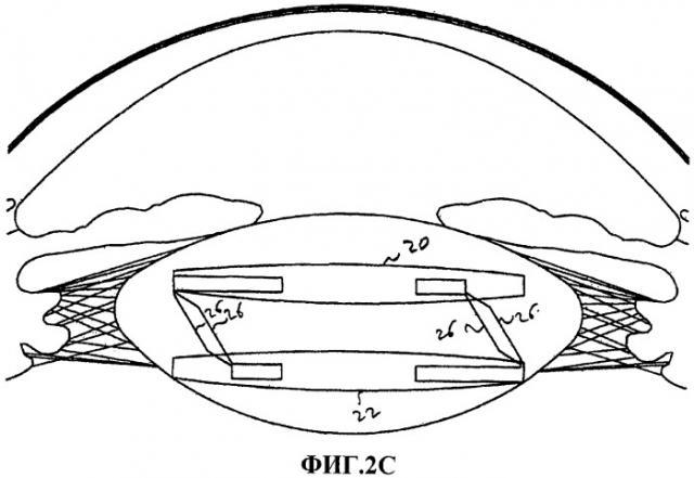 Двухэлементная система, обеспечивающая легкую аккомодацию с переменно-сферическим аберрационным контролем (патент 2465868)