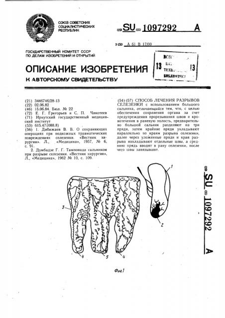 Способ лечения разрывов селезенки (патент 1097292)