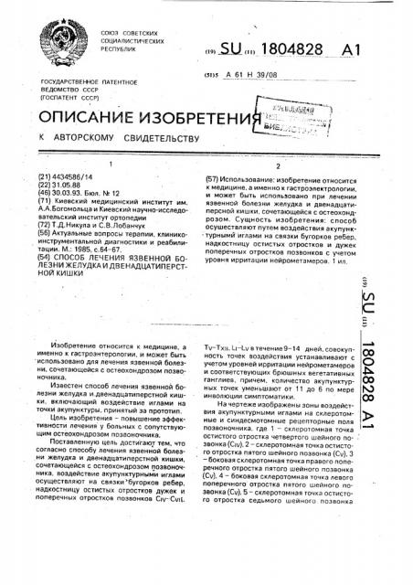 Способ лечения язвенной болезни желудка и двенадцатиперстной кишки (патент 1804828)