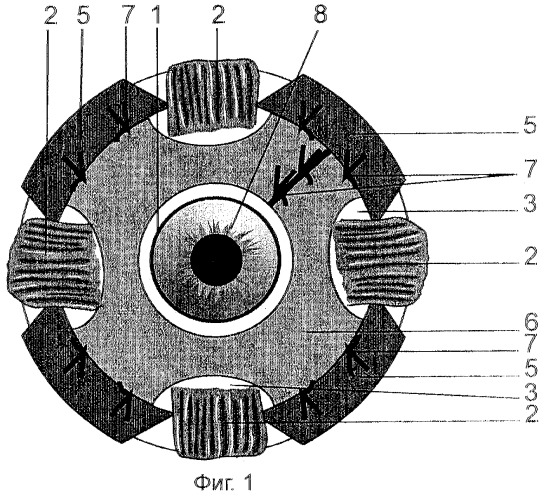 Способ лечения субатрофии глазного яблока (патент 2286117)