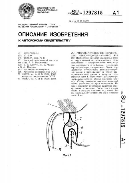 Способ лечения пенетрирующих пилородуоденальных язв (патент 1297815)