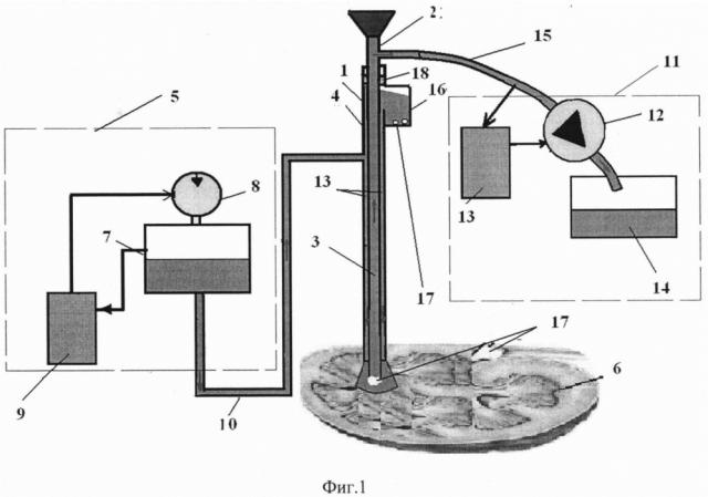 Устройство для чрескожного удаления фрагментов камней из полости почки (варианты) (патент 2637820)