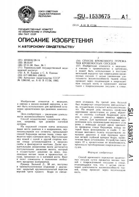 Способ временного пережатия кровеносных сосудов (патент 1533675)