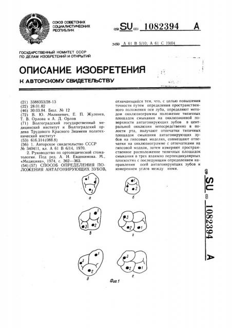 Способ определения положения антагонирующих зубов (патент 1082394)
