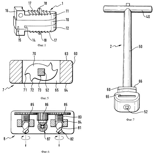 Протез шейного межпозвонкового диска с фиксирующим устройством и инструментами (патент 2372054)