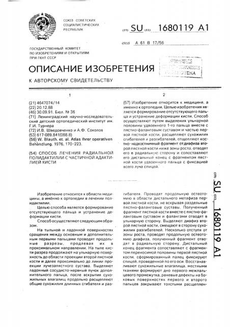 Способ лечения радиальной полидактилии с частичной адактилией кисти (патент 1680119)