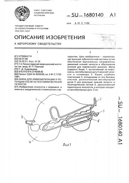 Шина для иммобилизации и ретенции после остеотомии верхней челюсти (патент 1680140)