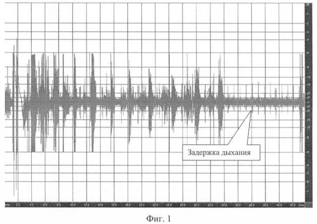 Способ фильтрации дыхательных шумов на основе задержки дыхания (патент 2415643)