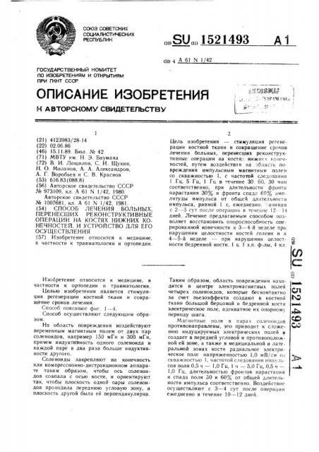 Способ лечения больных, перенесших реконструктивные операции на костях нижних конечностей и устройство для его осуществления (патент 1521493)