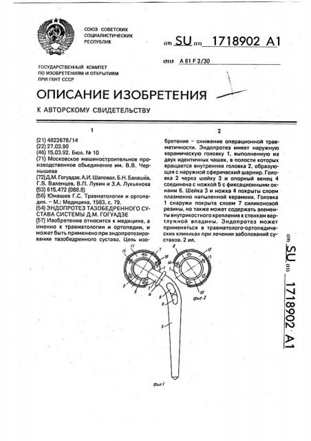 Эндопротез тазобедренного сустава системы д.м.гогуадзе (патент 1718902)