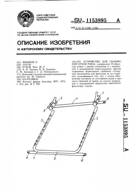 Устройство для сближения краев раны (патент 1153895)