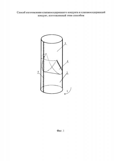Способ изготовления клапаносодержащего кондуита и клапаносодержащий кондуит, изготовленный этим способом (патент 2644287)