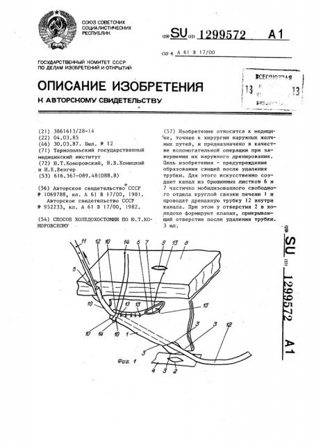 Способ холедохостомии по ю.т.коморовскому (патент 1299572)