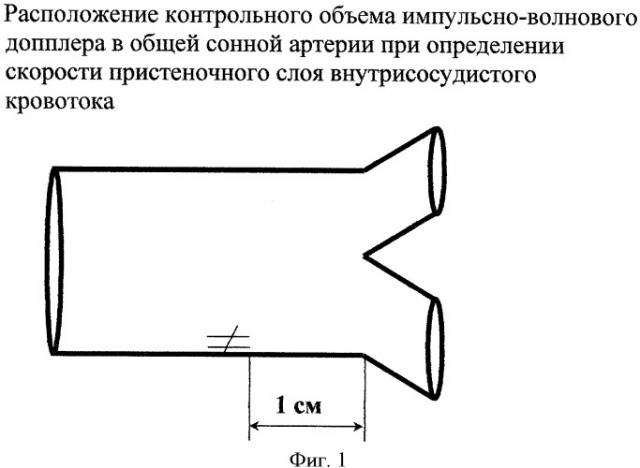 Способ диагностики ранних стадий атеросклероза (патент 2350273)