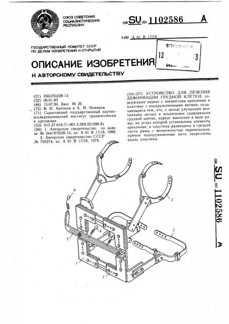 Устройство для лечения деформации грудной клетки (патент 1102586)