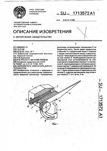 Направитель фиксатора для остеосинтеза (патент 1713572)