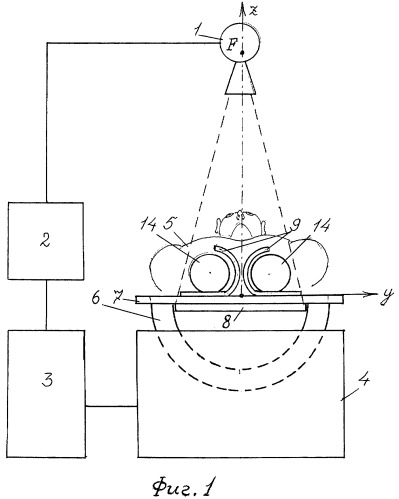 Устройство для стереорентгенограмметрии нижних мочевых путей (патент 2413463)