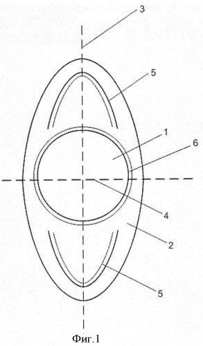 Искусственный хрусталик глаза для фиксации на край переднего капсулорексиса и/или в цилиарную борозду (патент 2523144)