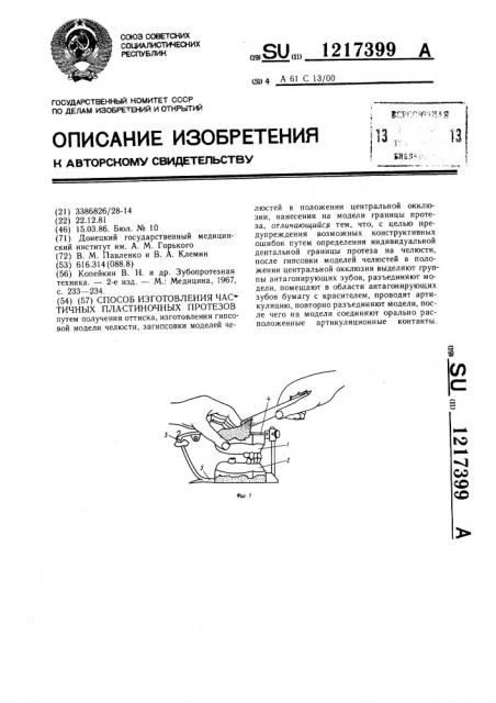 Способ изготовления частичных пластиночных протезов (патент 1217399)